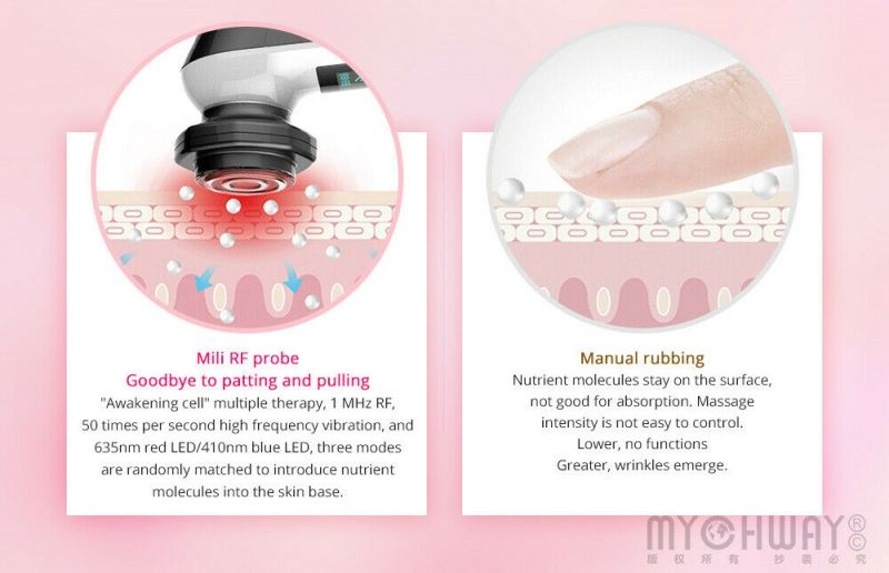 38223 Вибромассажер для лица 5в1 SMART V PRO (RF, LED, EMS) Beauty Star  - Вид №6